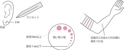 出血時間(しゅっけつじかん)とは？ 意味や使い方 - コトバンク