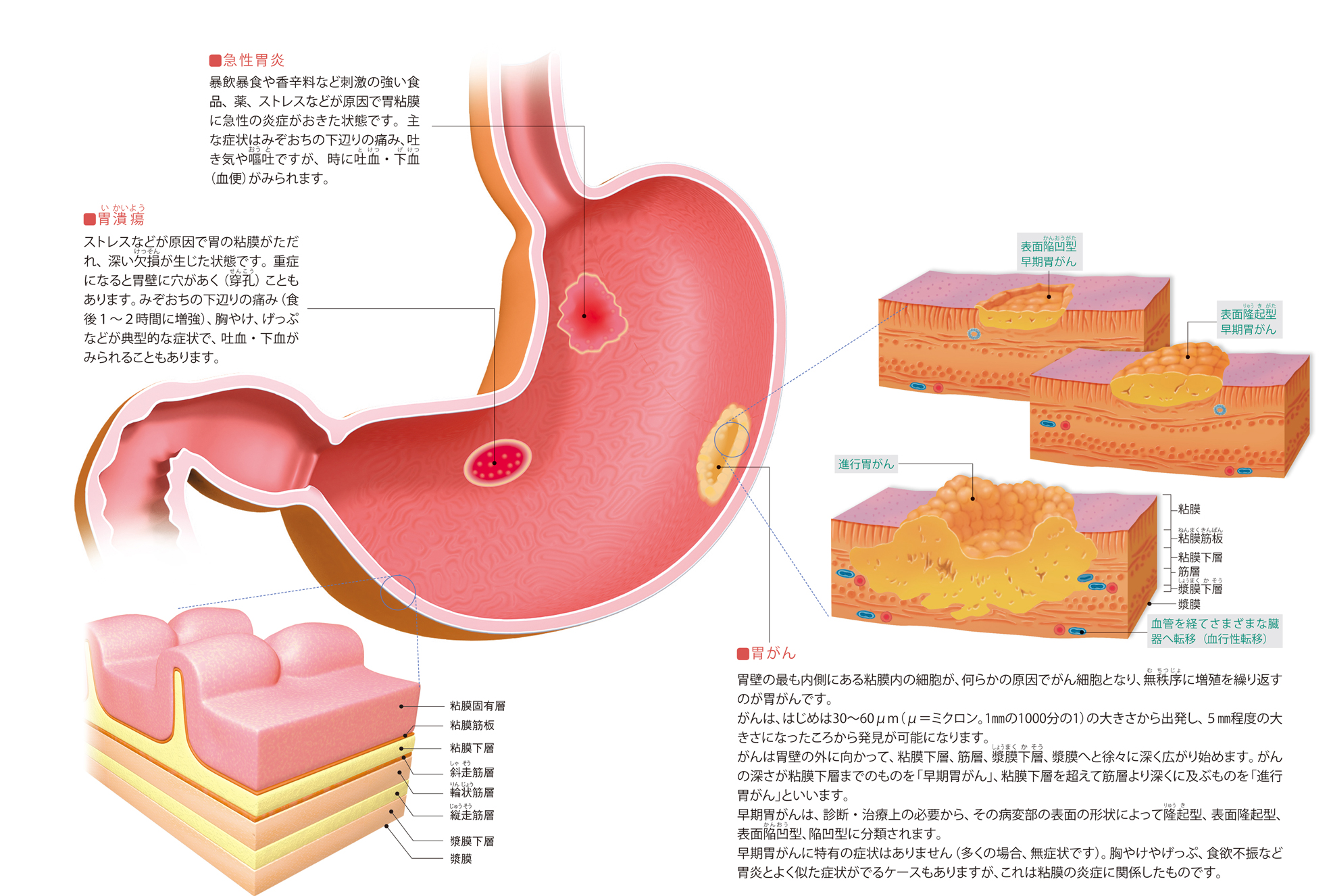 ある状態が他の状態を引き起こす可能性はありますか?