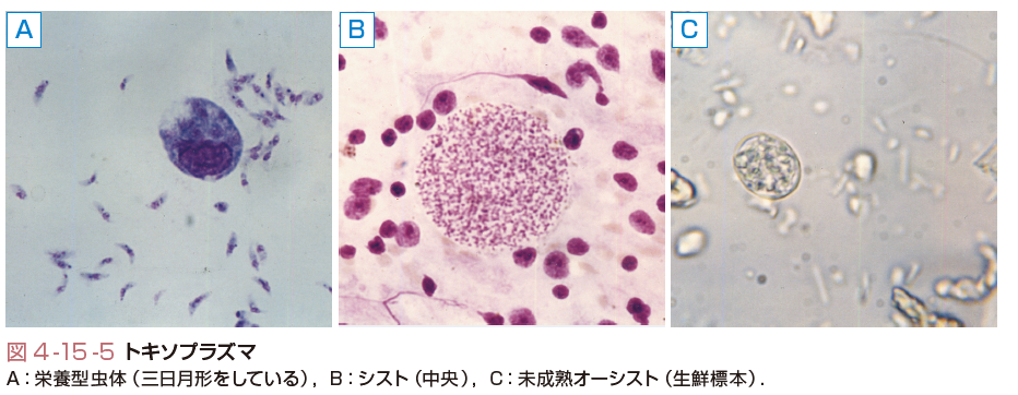 トキソプラズマ症と診断されたらどうなりますか?